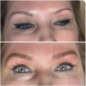 Microblading Before and After Photos of Clients at Laser Duet Med Spa in Dearborn, MI Microblading Before and After Photos of Clients at Laser Duet Med Spa in Dearborn, MI