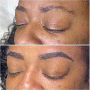 Microblading Before and After Photos of Clients at Laser Duet Med Spa in Dearborn, MI Microblading Before and After Photos of Clients at Laser Duet Med Spa in Dearborn, MI