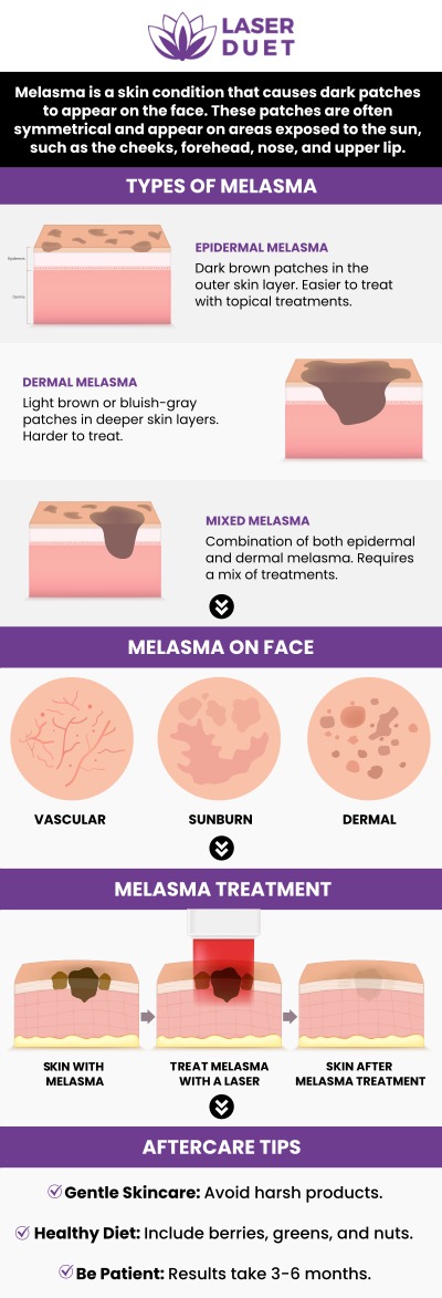 Melasma Treatment at Laser Duet Med Spa in Dearborn, MI Melasma Treatment at Laser Duet Med Spa in Dearborn, MI