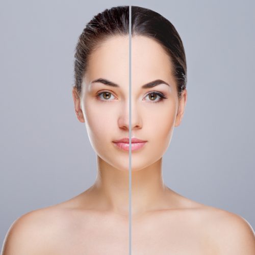 Top Skin Pigmentation Treatment in Dearborn, MI