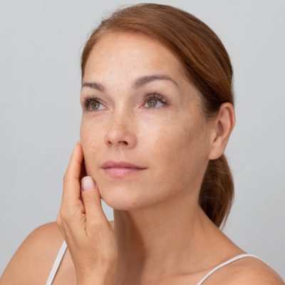 Top Dark Spot Laser Treatment Specialist in Dearborn, MI