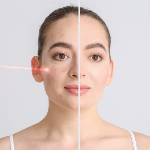 Common Pigmentation Conditions We Treat Common Pigmentation Conditions We Treat