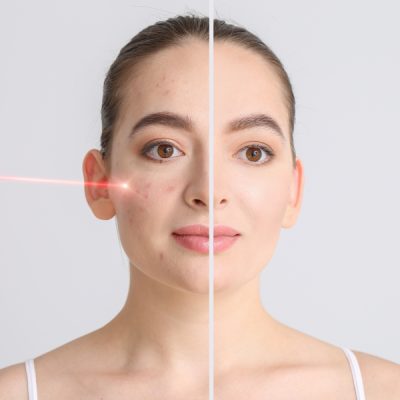 Common Pigmentation Conditions We Treat Common Pigmentation Conditions We Treat